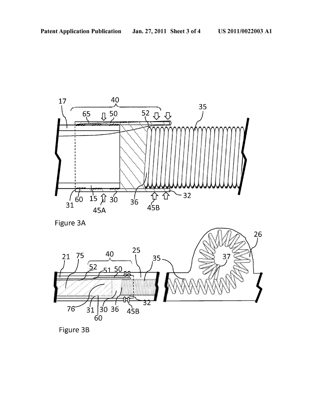 DETACHABLE EMBOLIZATION COIL - diagram, schematic, and image 04