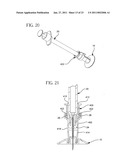 Method and apparatus for delivering a therapeutic substance through an injection port diagram and image