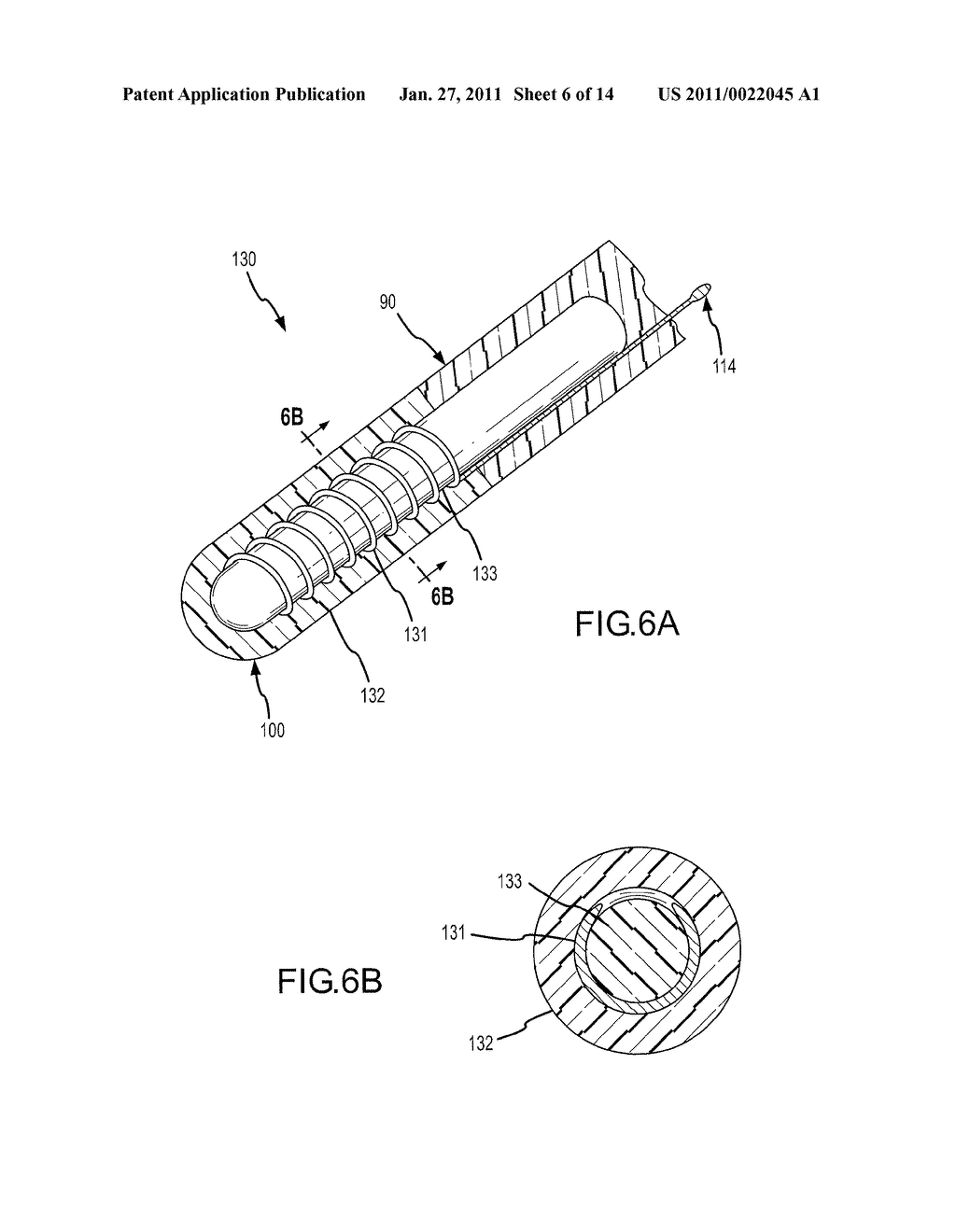 Ablation electrodes with capacitive sensors for resolving magnitude and direction of forces imparted to a distal portion of a cardiac catheter - diagram, schematic, and image 07