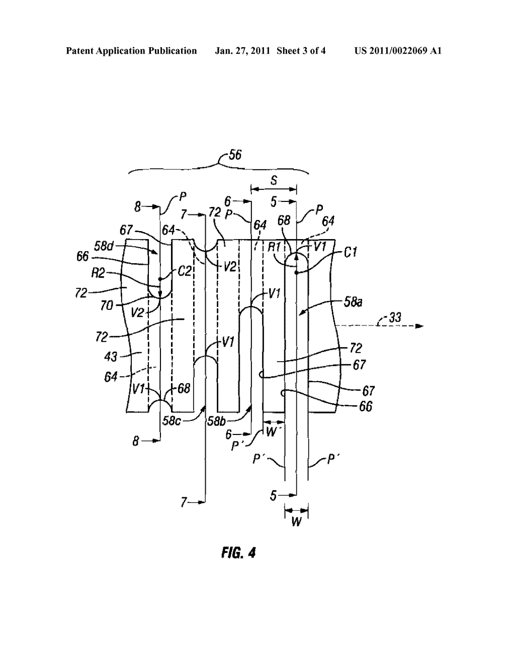 Flexible Inner Member Having a Flexible Region Composed of Longitudinally and Rotationally Offset Partial Circumferential Cuts - diagram, schematic, and image 04