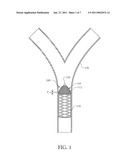 PERMANENT ARTERIAL EMBOLI DISSOLUTION FILTER TO PREVENT EMBOLIC OCCLUSION OF A BLOOD VESSEL diagram and image