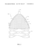 PERMANENT ARTERIAL EMBOLI DISSOLUTION FILTER TO PREVENT EMBOLIC OCCLUSION OF A BLOOD VESSEL diagram and image