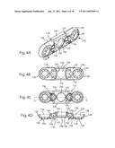 SPINOUS PROCESS FUSION IMPLANTS diagram and image