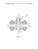 SPINOUS PROCESS FUSION IMPLANTS diagram and image