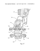 SPINOUS PROCESS FUSION IMPLANTS diagram and image