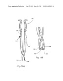 SPINOUS PROCESS FUSION IMPLANTS diagram and image