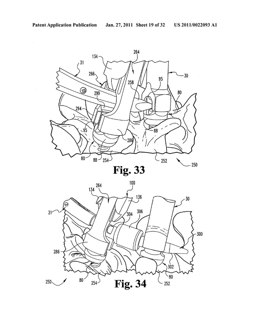 SYSTEMS AND METHODS FOR SPINAL STABILIZATION WITH FLEXIBLE ELEMENTS - diagram, schematic, and image 20