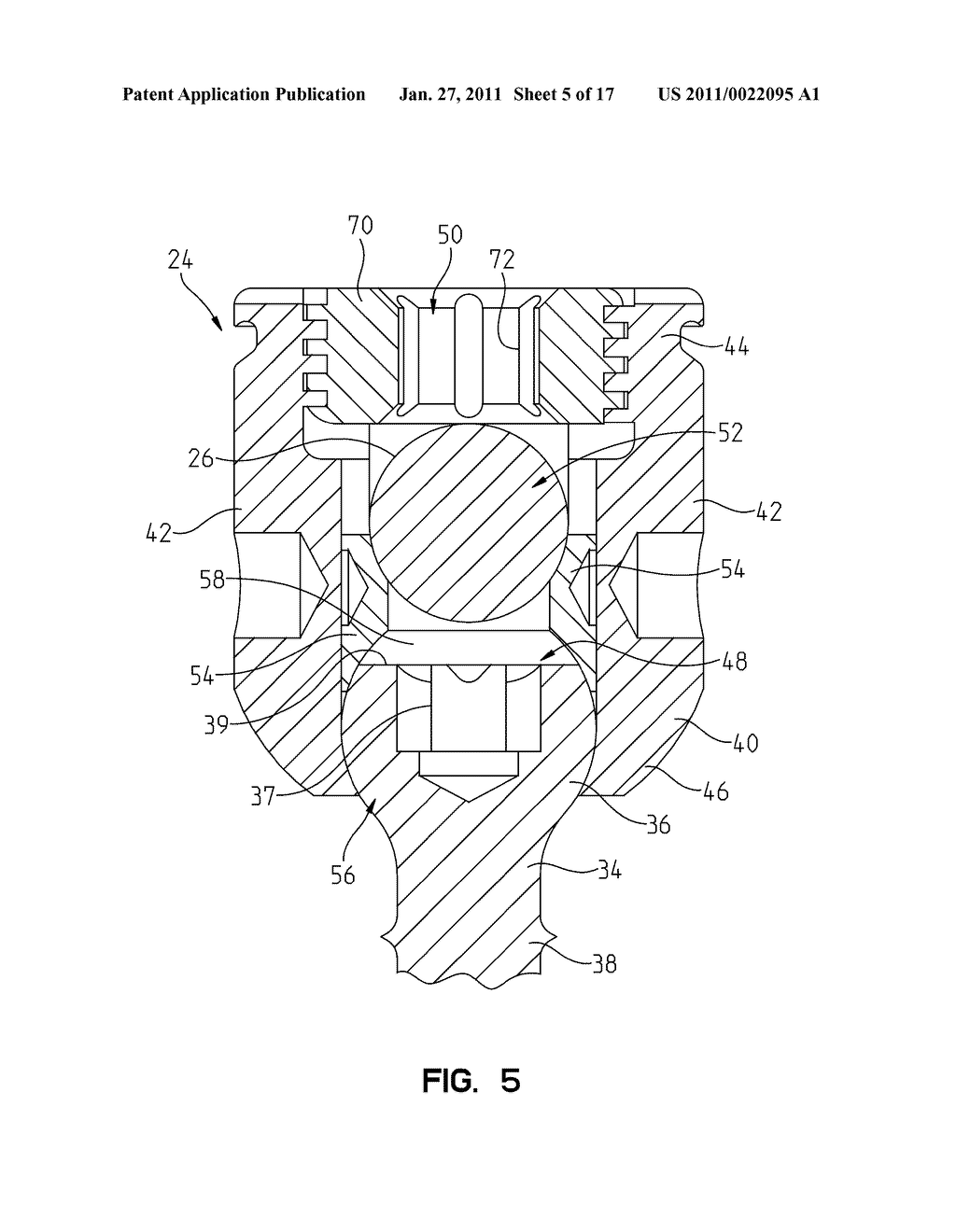 Modular Multi-Level Spine Stabilization System and Method - diagram, schematic, and image 06