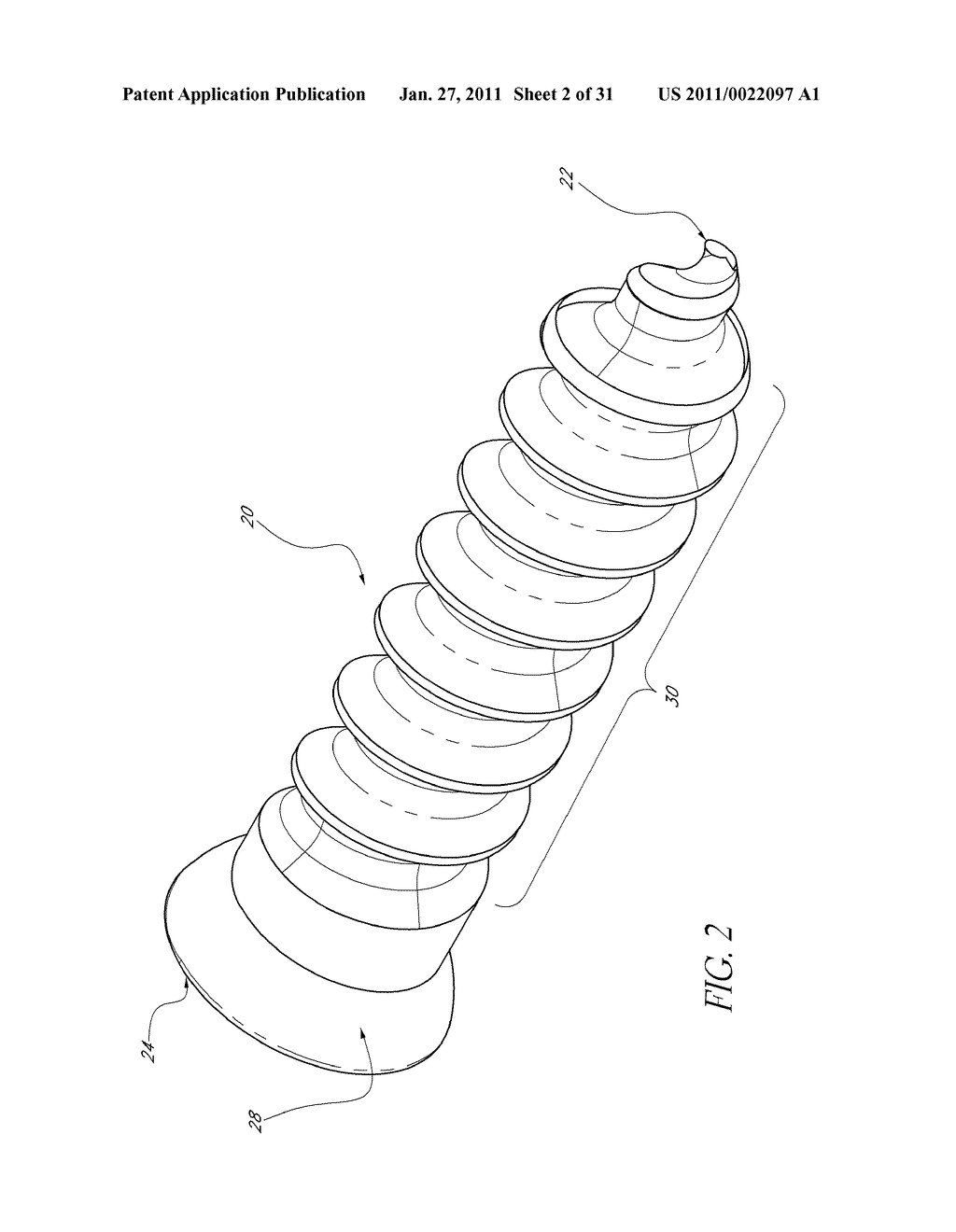 BONE PLATE SCREW-BLOCKING SYSTEMS AND METHODS - diagram, schematic, and image 03