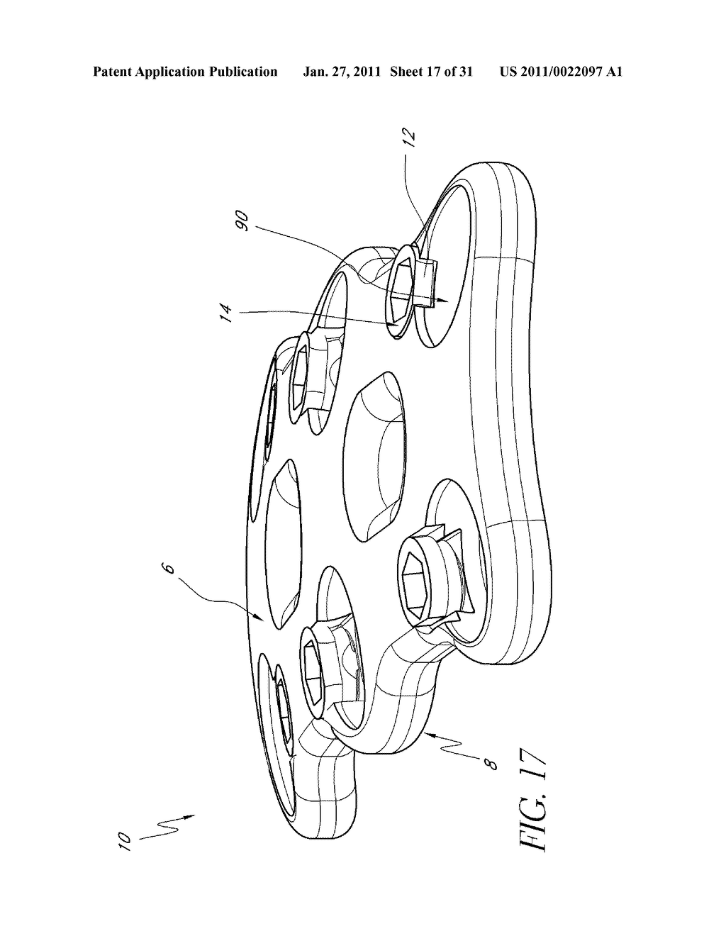 BONE PLATE SCREW-BLOCKING SYSTEMS AND METHODS - diagram, schematic, and image 18