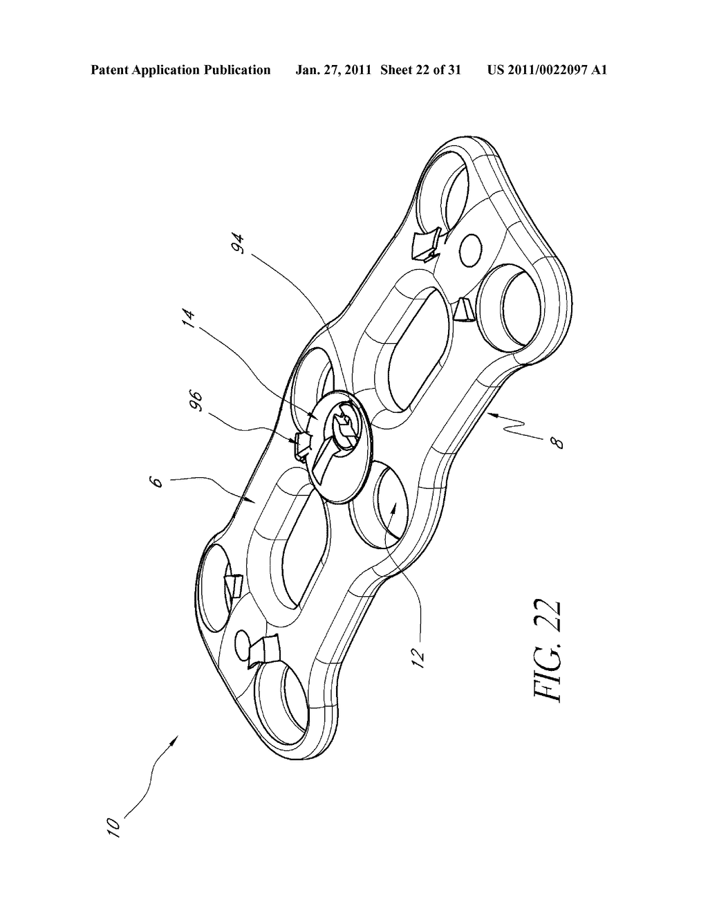 BONE PLATE SCREW-BLOCKING SYSTEMS AND METHODS - diagram, schematic, and image 23