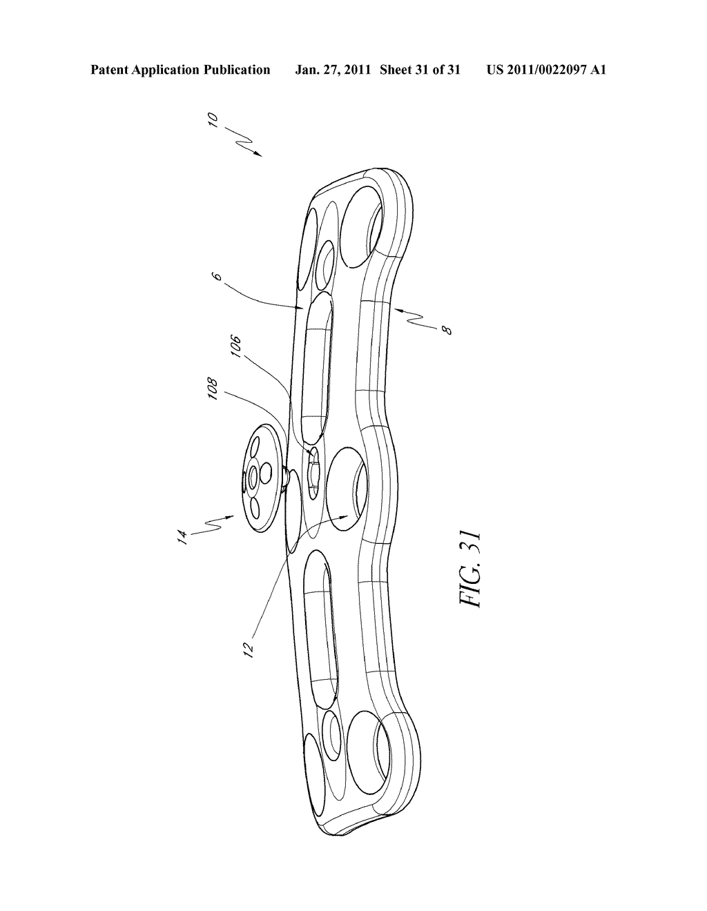 BONE PLATE SCREW-BLOCKING SYSTEMS AND METHODS - diagram, schematic, and image 32