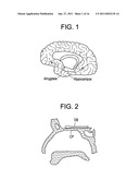 Intranasal Red Light Probe For Treating Alzheimer s Disease diagram and image