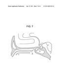 Intranasal Red Light Probe For Treating Alzheimer s Disease diagram and image