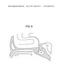 Intranasal Red Light Probe For Treating Alzheimer s Disease diagram and image