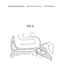 Intranasal Red Light Probe For Treating Alzheimer s Disease diagram and image