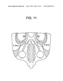 Intranasal Red Light Probe For Treating Alzheimer s Disease diagram and image