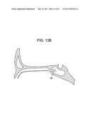 Intranasal Red Light Probe For Treating Alzheimer s Disease diagram and image