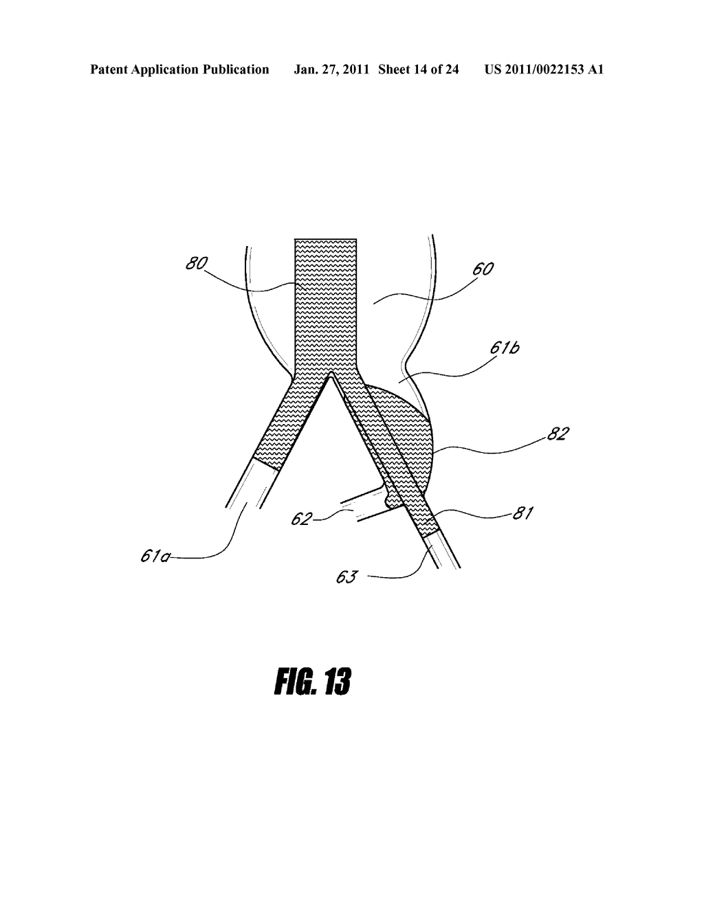 STENT GRAFT - diagram, schematic, and image 15