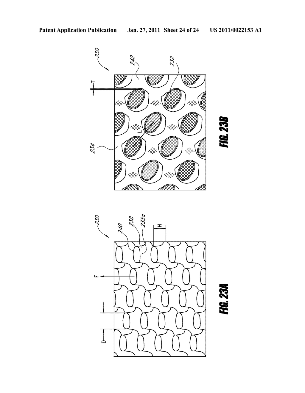 STENT GRAFT - diagram, schematic, and image 25