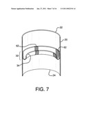 ENDOLUMINAL PROSTHETIC CONDUIT SYSTEMS AND METHOD OF COUPLING diagram and image