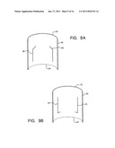 ENDOLUMINAL PROSTHETIC CONDUIT SYSTEMS AND METHOD OF COUPLING diagram and image