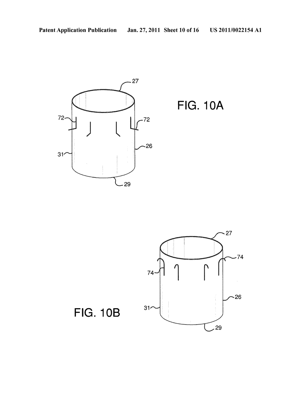 ENDOLUMINAL PROSTHETIC CONDUIT SYSTEMS AND METHOD OF COUPLING - diagram, schematic, and image 11