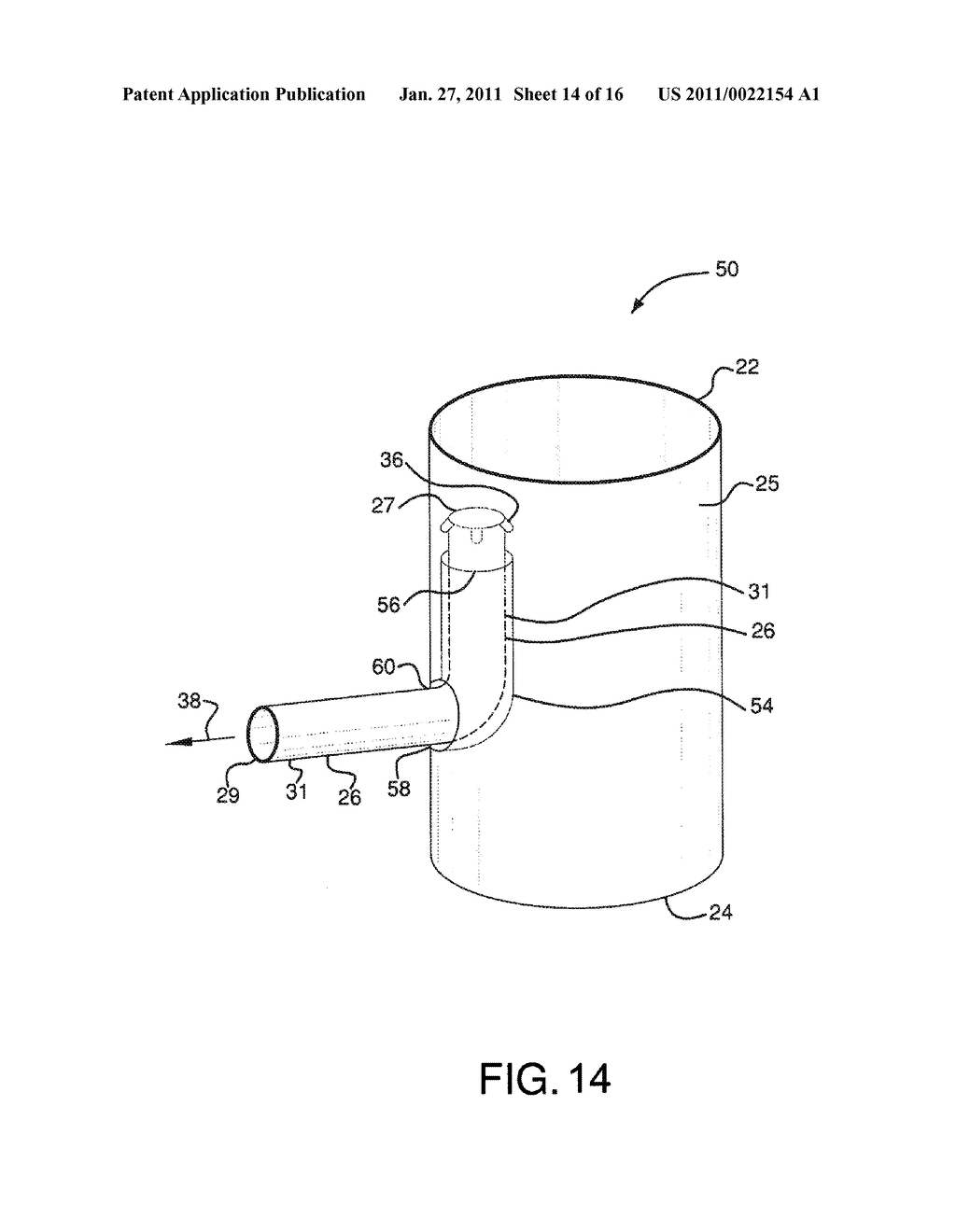 ENDOLUMINAL PROSTHETIC CONDUIT SYSTEMS AND METHOD OF COUPLING - diagram, schematic, and image 15