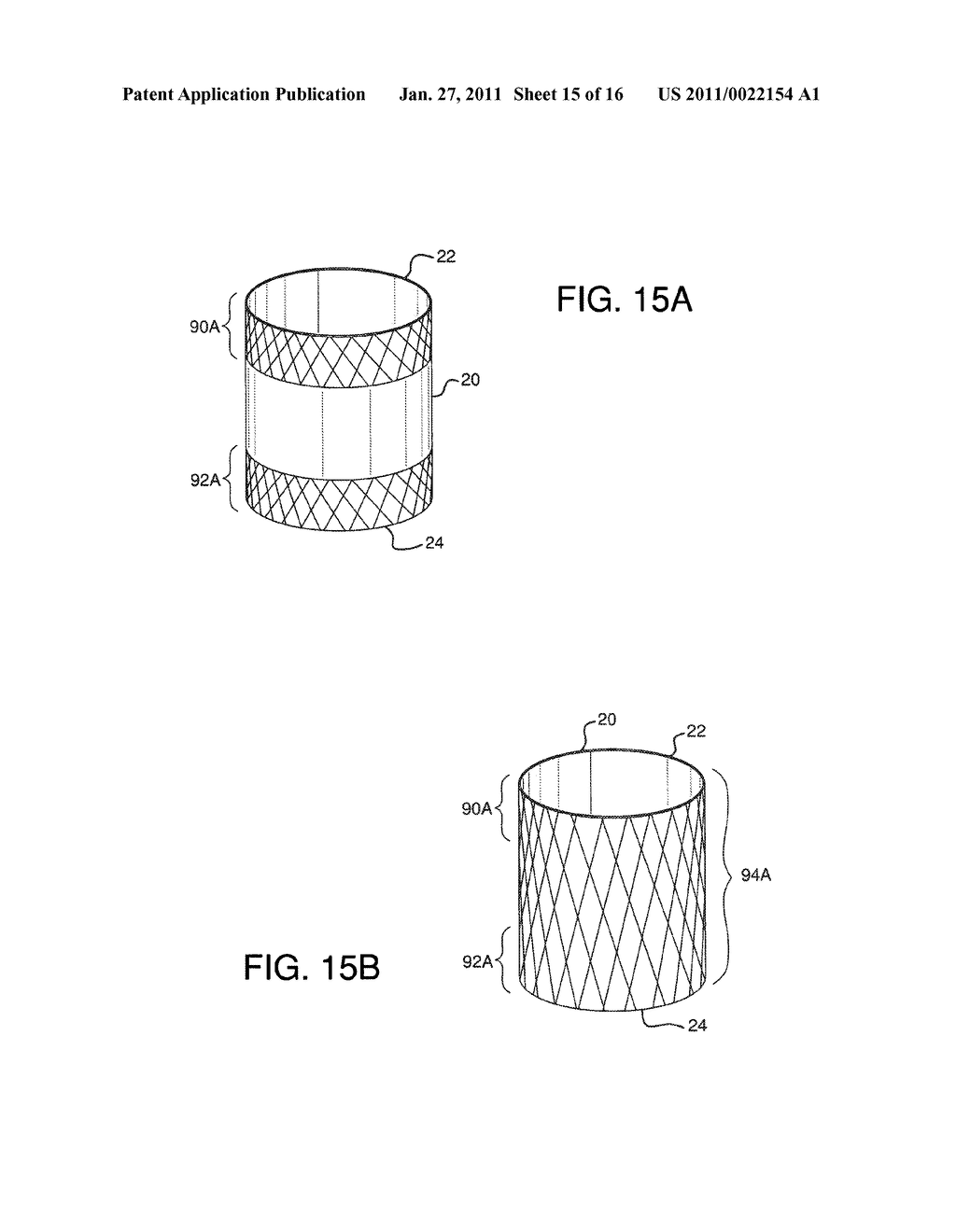 ENDOLUMINAL PROSTHETIC CONDUIT SYSTEMS AND METHOD OF COUPLING - diagram, schematic, and image 16