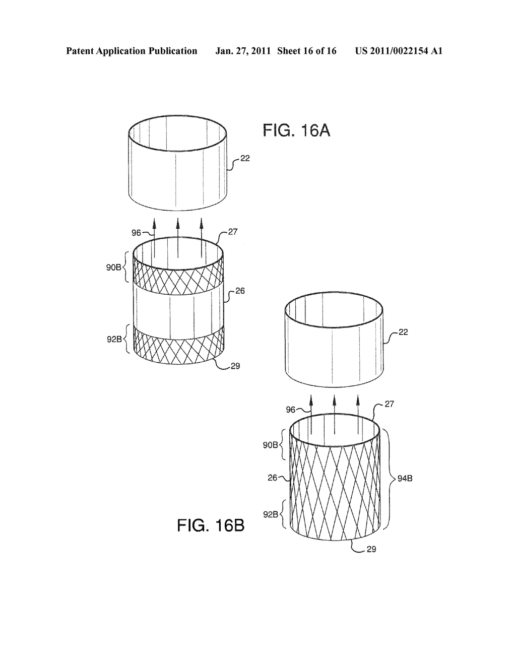 ENDOLUMINAL PROSTHETIC CONDUIT SYSTEMS AND METHOD OF COUPLING - diagram, schematic, and image 17