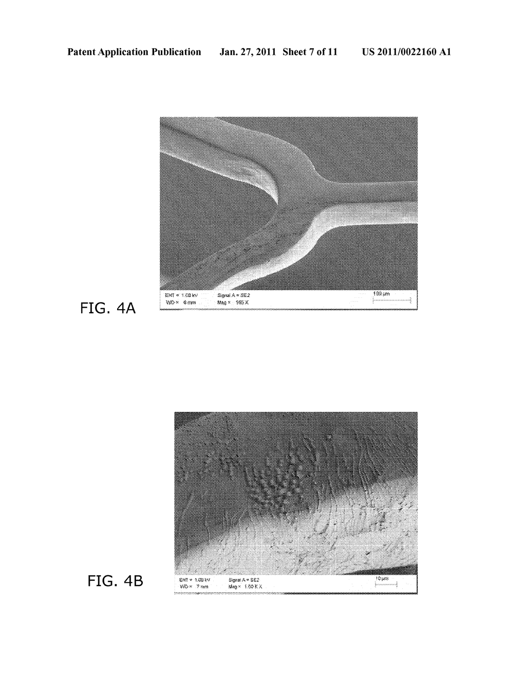 Medical Devices Having an Inorganic Coating Layer Formed by Atomic Layer Deposition - diagram, schematic, and image 08