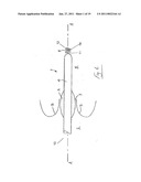 MEDICAL DEVICE FOR USE IN TREATMENT OF A VALVE diagram and image