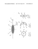 MEDICAL DEVICE FOR USE IN TREATMENT OF A VALVE diagram and image