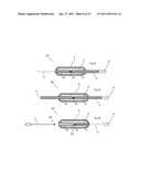 MEDICAL DEVICE FOR USE IN TREATMENT OF A VALVE diagram and image