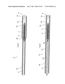 MEDICAL DEVICE FOR USE IN TREATMENT OF A VALVE diagram and image