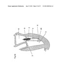 MEDICAL DEVICE FOR USE IN TREATMENT OF A VALVE diagram and image