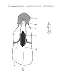 MEDICAL DEVICE FOR USE IN TREATMENT OF A VALVE diagram and image