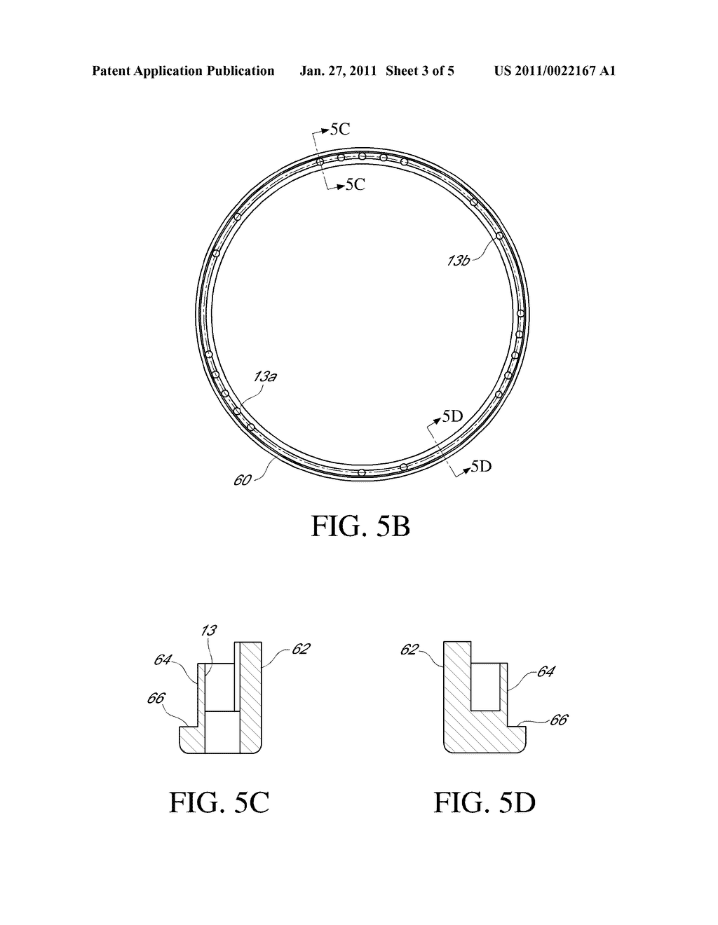 INTRAPARIETAL AORTIC VALVE REINFORCEMENT DEVICE AND A REINFORCED BIOLOGICAL AORTIC VALVE - diagram, schematic, and image 04