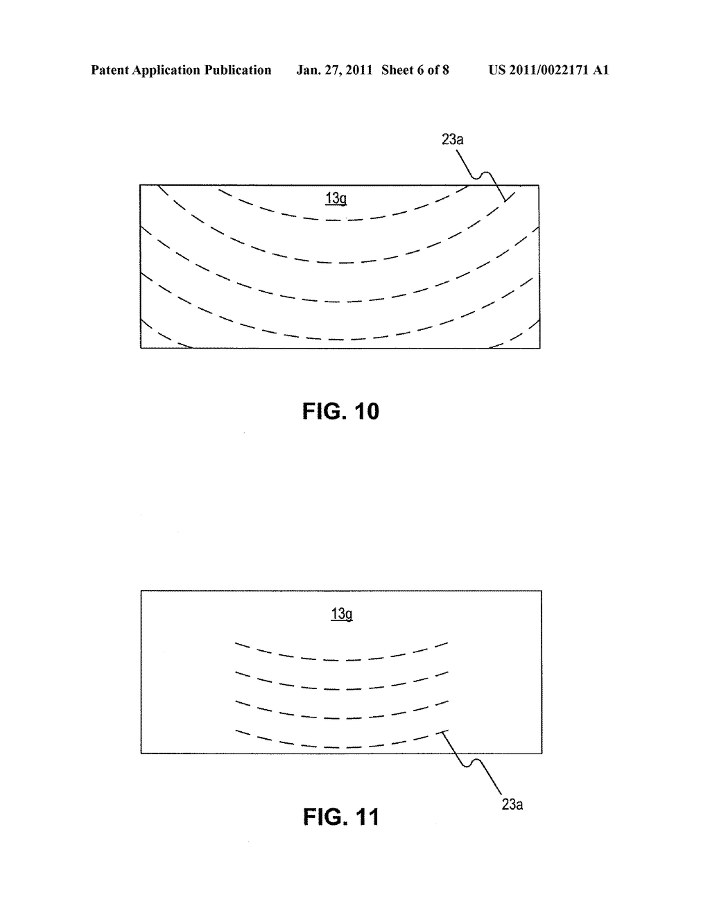 Graft Materials for Surgical Breast Procedures - diagram, schematic, and image 07