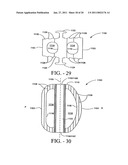 Intervertebral body fusion cage with keels and implantation methods diagram and image