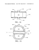 Intervertebral body fusion cage with keels and implantation methods diagram and image