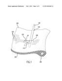 SAW BLADE FOR REMOVING A SECTION FROM A TIRE diagram and image