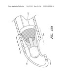 MEDICAL TUBE CLEANING APPARATUS diagram and image