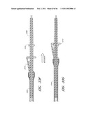 MEDICAL TUBE CLEANING APPARATUS diagram and image