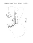 MEDICAL TUBE CLEANING APPARATUS diagram and image