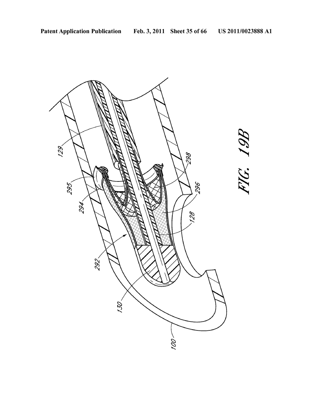 METHODS FOR REMOVING DEBRIS FROM MEDICAL TUBES - diagram, schematic, and image 36