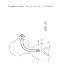 METHODS FOR REMOVING DEBRIS FROM MEDICAL TUBES diagram and image