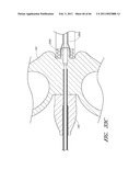 METHODS FOR REMOVING DEBRIS FROM MEDICAL TUBES diagram and image