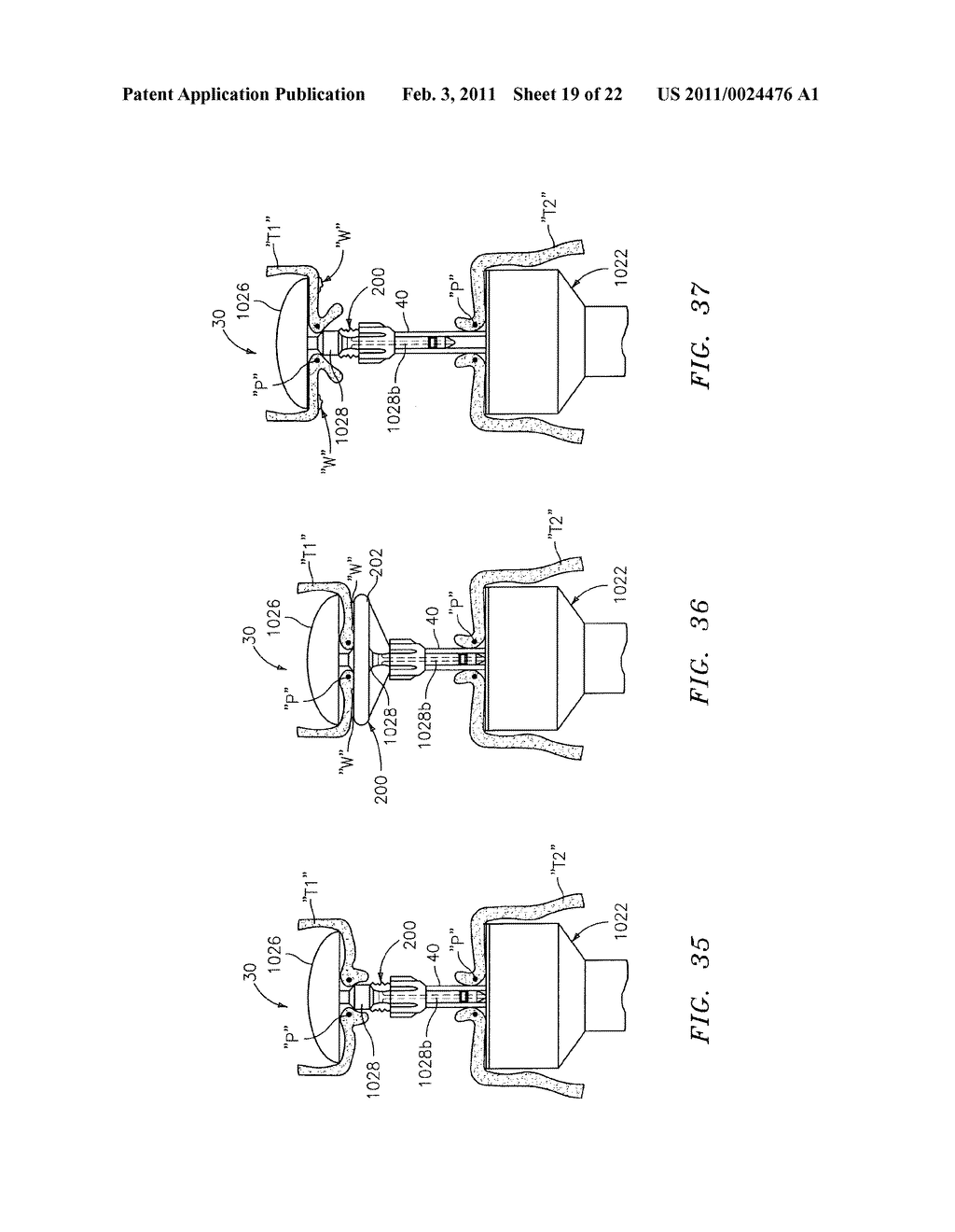 Annular Adhesive Structure - diagram, schematic, and image 20