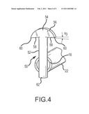 PICKUP BOX RETRIEVAL IMPLEMENT diagram and image